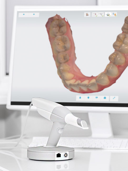 Tecnología de última generación en la clínica dental