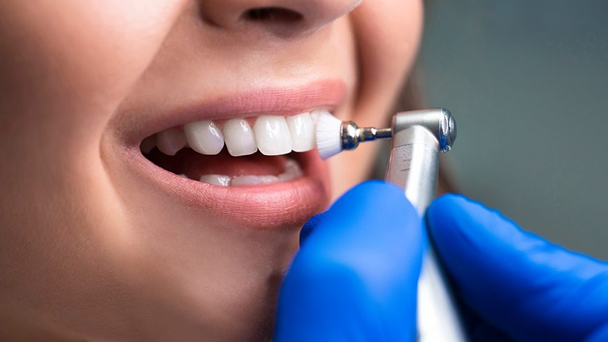 ¿Una limpieza dental duele?
