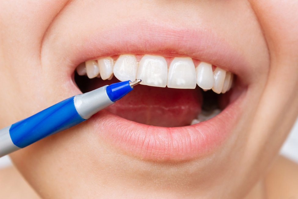 ¿Por qué salen manchas blancas en los dientes?