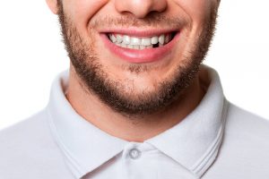 ausencia dental sin implante