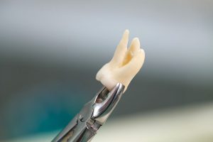 Instrumental básico en tu clínica dental de confianza.