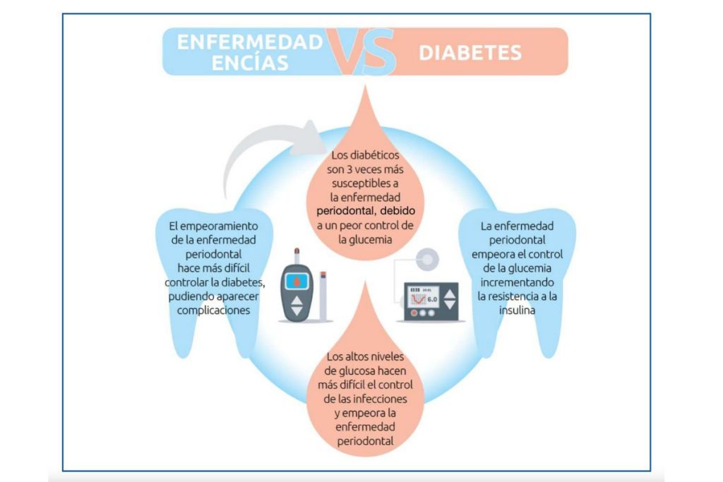 Diabetes y periodontitis, relación directa.
