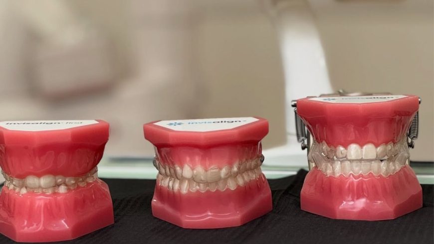 5 errores comunes (o más) en pacientes con Invisalign.