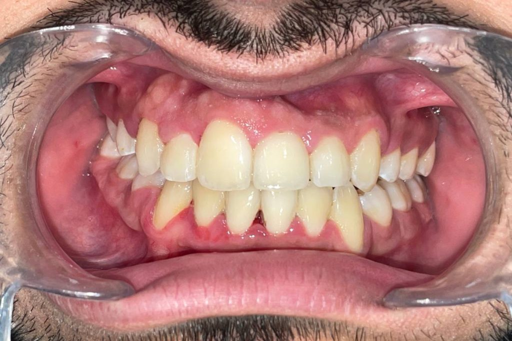 Imagen completa del paciente post tratamiento dental.