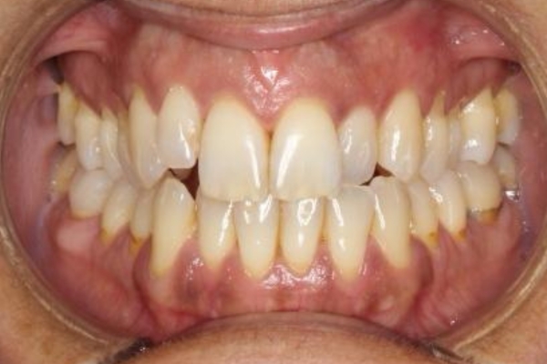 After image