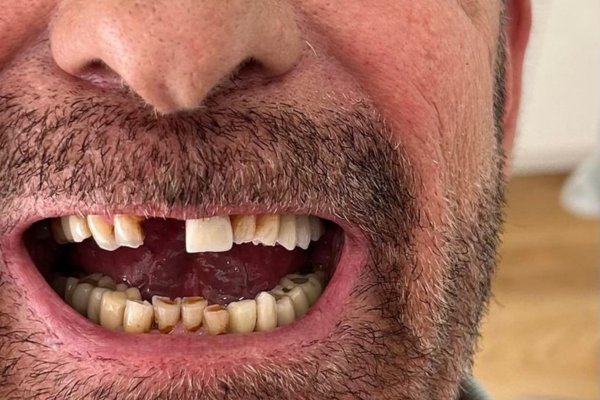 Quiero arreglarme la boca, en Torremolinos