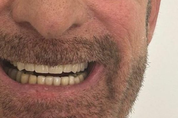 Resultado final del tratamiento integral del caso 389, en Torremolinos.