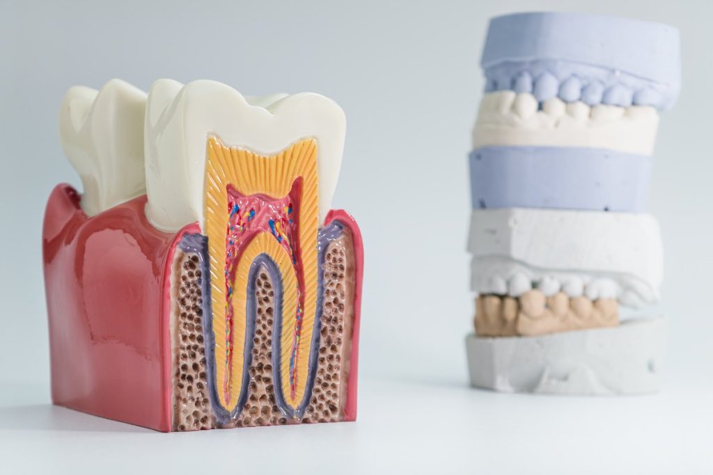 Pulpa dental de una muela.